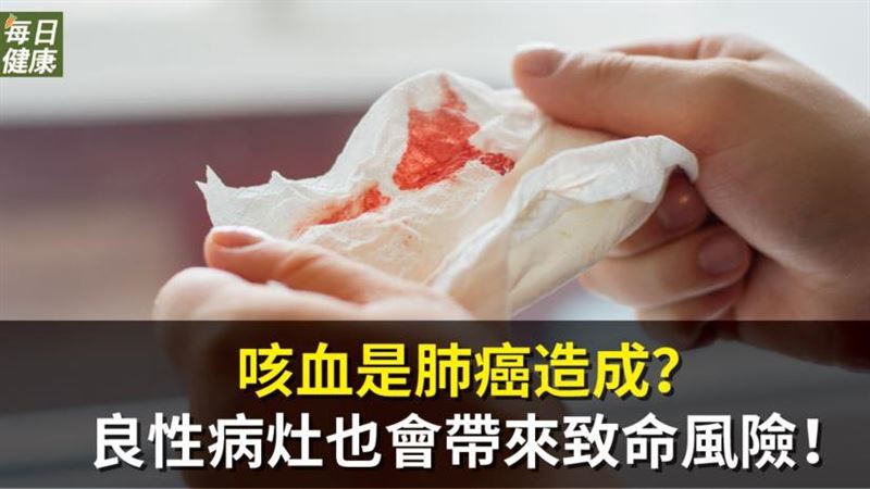 咳血是肺癌造成？　驚呼吸道阻塞致命