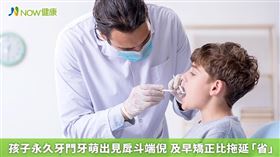 名家專用／宋慧玲醫師指出不論是機能性或骨骼性戽斗，都應把握7至11歲的矯正黃金期，才能及時挽救孩子的戽斗。(勿用)