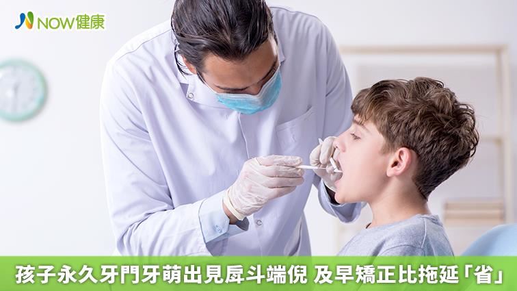 孩子永久牙門牙萌出見戽斗端倪