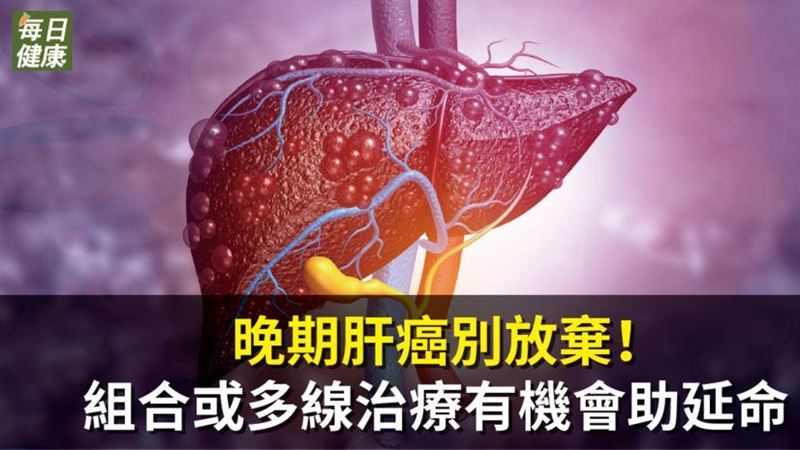 晚期肝癌別放棄！免疫組合療法見曙光