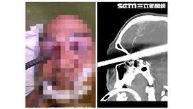 高雄,長庚,鋼筋,工人,建築,腦,高雄長庚提供