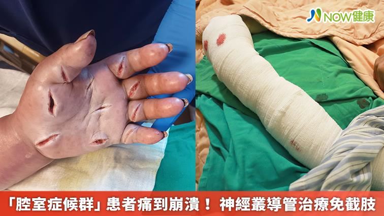 「腔室症候群」患者痛到崩潰！