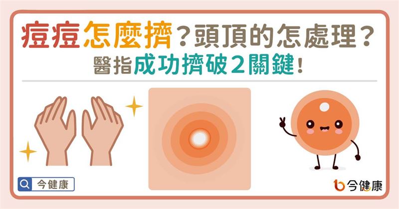 痘痘怎麼擠？　醫指成功擠破2關鍵