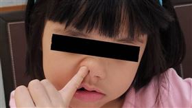 鼻孔會愈挖愈大？醫曝亂摳「3下場」