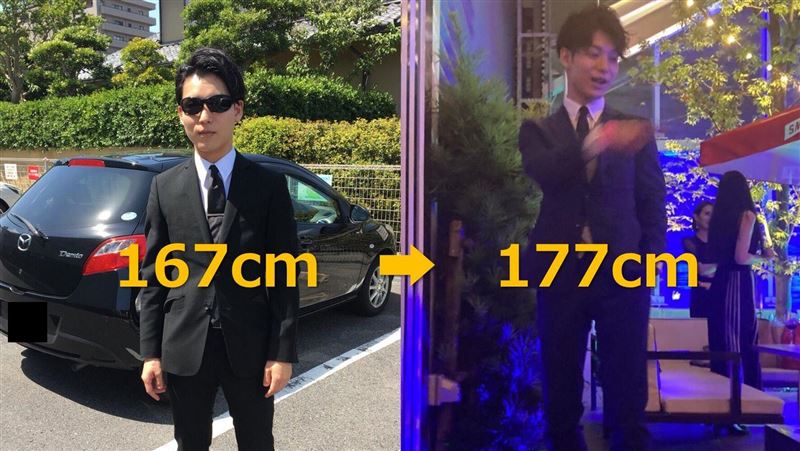 167男斷腿手術　變高富帥逆轉人生