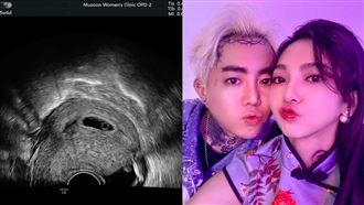 還沒3個月　莉婭曬超音波照證實懷孕