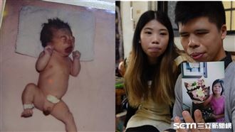 母癌逝姊照顧罕病弟：結婚也會帶著他