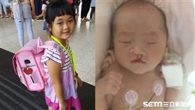 小蛋餅／羅慧夫顱顏基金會授權提供