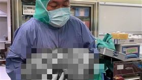 22公斤的巨大「惡性肉瘤」。（圖／邱文祥醫師提供）