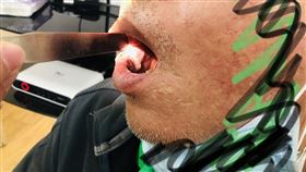 張益豪醫師提供