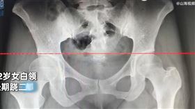 蹺二郎腿　Ｘ光
https://weibo.com/7590570074/Ll1YsDGnI?layerid=4750124809457710