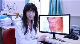 正妹衝浪落海，左手腕被水螫傷，水泡爛掉，（圖／翻攝畫面）