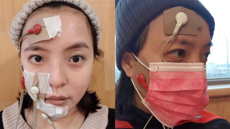 女星突然臉歪嘴斜　以為中風親揭病況