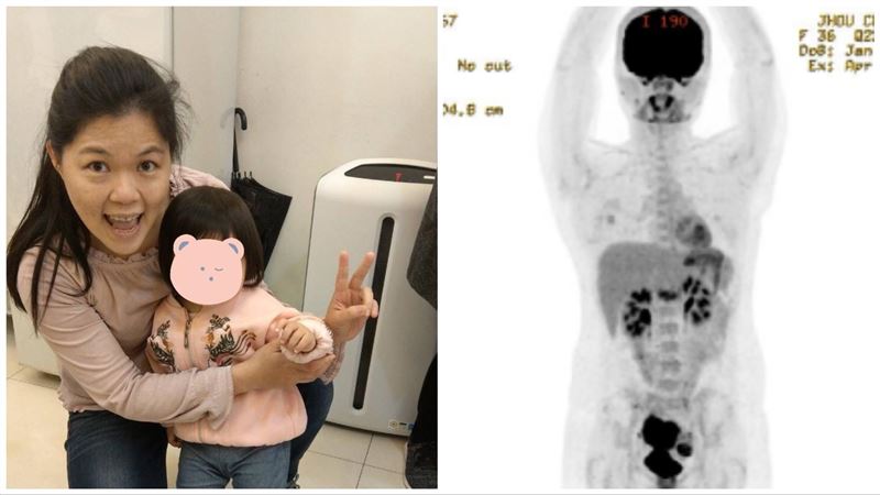 四期腸癌2度復發　她：想看女兒長大
