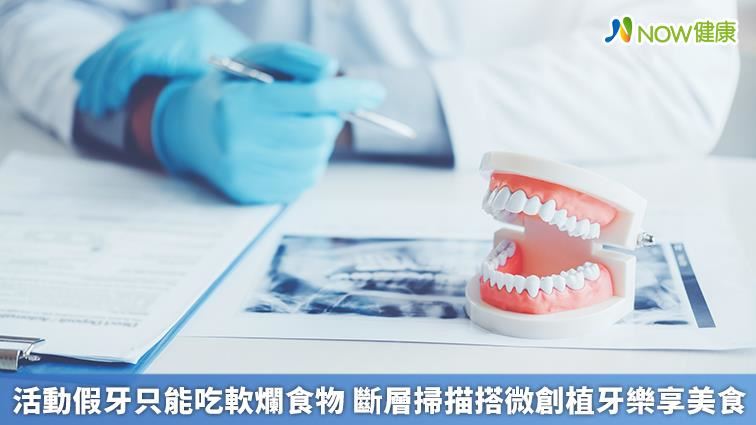 活動假牙只能吃軟爛食物？