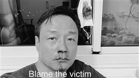 香港男演員王喜3日發「通緝文」稱，入境台灣在機場PCR採檢，遭捅傷流鼻血。（圖／翻攝自王喜臉書）