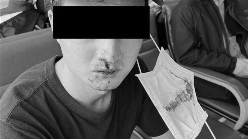 陸男在台PCR被捅爆血　氣炸開譙
