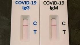 確診者到過「張惠妹演唱會」　男友Sam急快篩結果出爐
IG