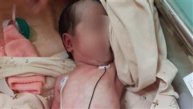 小女嬰全身長滿紅疹。（圖／烏日林新醫院提供）