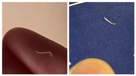 蟯蟲,肛門,生菜