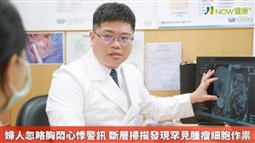 名家專用／泌尿科醫師許俊凱說明嗜鉻細胞瘤手術進行方式。(勿用)