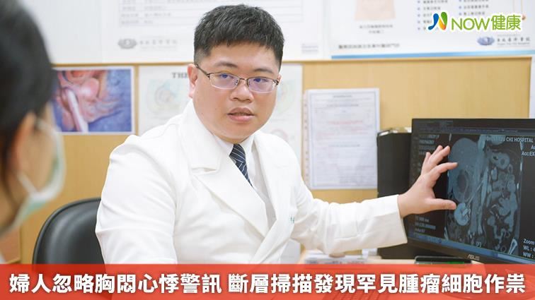 婦人胸悶心悸　掃描發現罕見腫瘤細胞