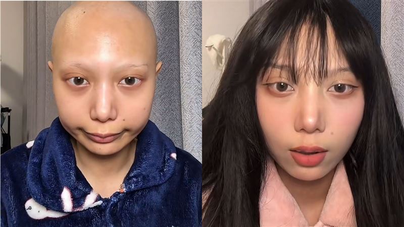正妹網紅21歲罹癌　摘卵巢終生不孕