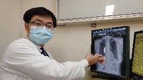 刷牙誤吞18公分牙刷  屏基以胃鏡取