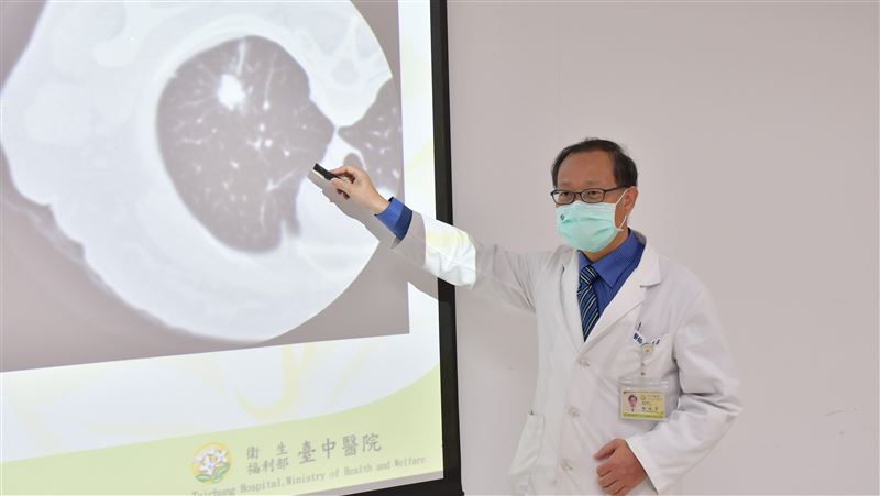 她不抽菸卻得肺腺癌　2件事是導火線