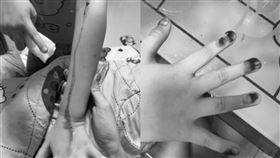 血汗病,疫苗,女童,冒血