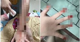 泰國7歲女童打疫苗後罹患血汗症