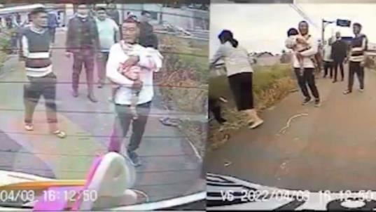 比特犬大發狂　屏東2歲女童復健路遙