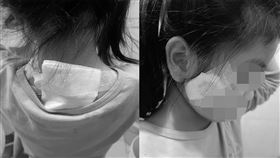 犬隻傷人,5歲女童,咬傷,飼主,開罰