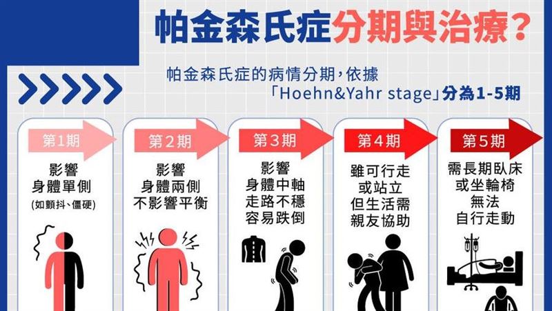 帕金森氏症懶人包　有哪些治療方式