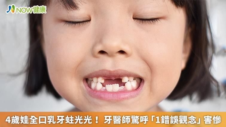 四歲娃乳牙蛀光光　牙醫師曝關鍵錯誤