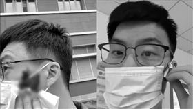 血管瘤,山海視頻,痘痘