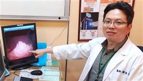 江先生斷層掃描下呈現左側腎臟癌。（圖／阮綜合醫院提供）