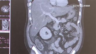 36歲男喝鱉血狂拉　猛爆性肝炎險死