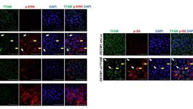 免疫螢光分析顯示粒線體轉錄因子(TFAM)大量表現，可抑制頭頸癌細胞傳遞路徑。（圖／陽交大提供）