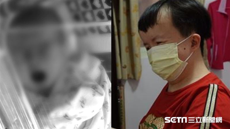 沒塞紅包醫拒開刀　單親媽養病女終生
