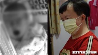 沒塞紅包醫拒開刀　單親媽養病女終生