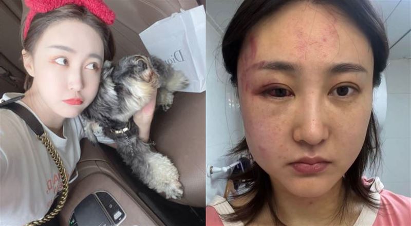 半年遭家暴4次　百萬網紅曝瀕死過程