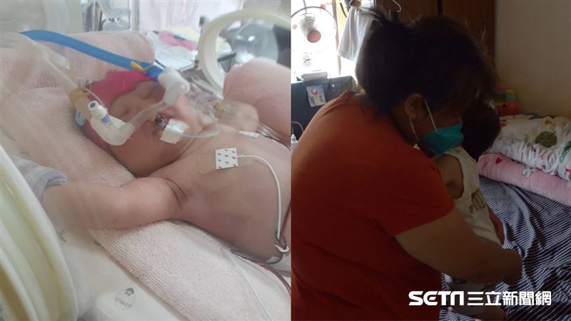 唇腭裂童遭母放棄　無血緣嬤無悔扶養