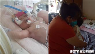 唇腭裂童遭母放棄　無血緣嬤無悔扶養