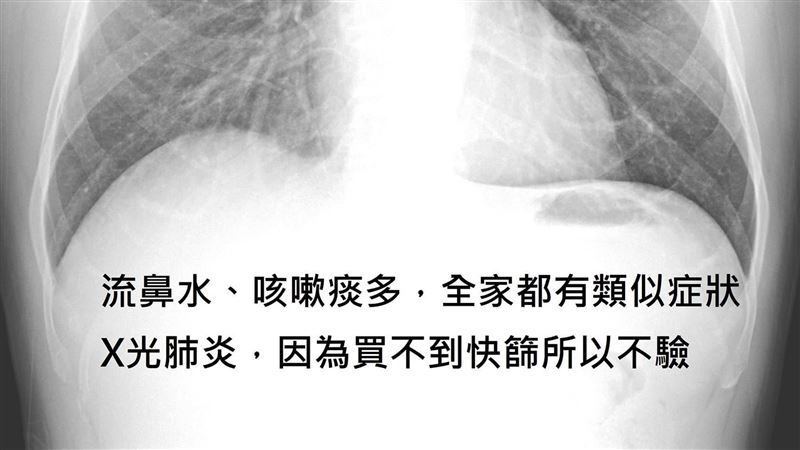 曝感染黑數　醫嘆：不驗就不會確診