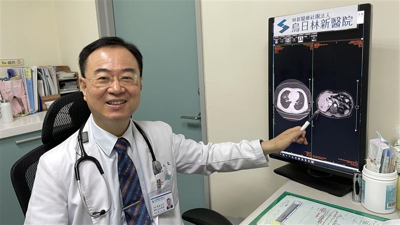 男右肺長雞蛋大腫瘤　醫這招助退癌王