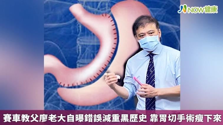 賽車教父減重黑歷史　最終靠胃切手術