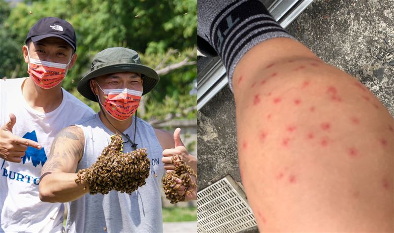 李玖哲雙腿滿包紅腫　中斷行程急送醫