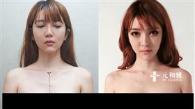 莉亞Lia,元雅和醫美廣告(圖/翻攝自官網)