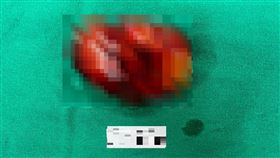 長安醫院泌尿科醫師黃煒軒(長安醫院提供)